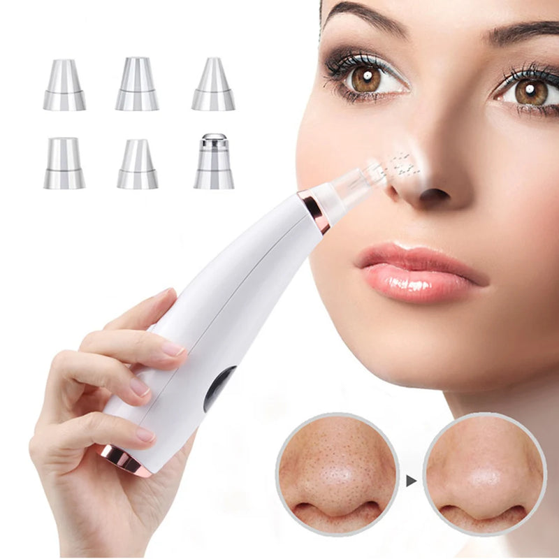 Removedor de cravo elétrico Aspirador de acne Limpador de manchas pretas Remoção facial de limpeza profunda Máquina de limpeza de poros Ferramentas de cuidados com a pele