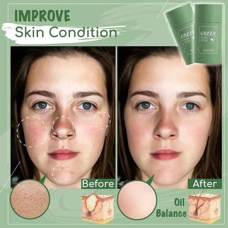 Removedor de cravo Máscara Facial Creme Máscara de limpeza profunda Facial Dissipar Acne Mancha Encolher Poros Coreano Beleza Cosméticos Cuidados com a Pele
